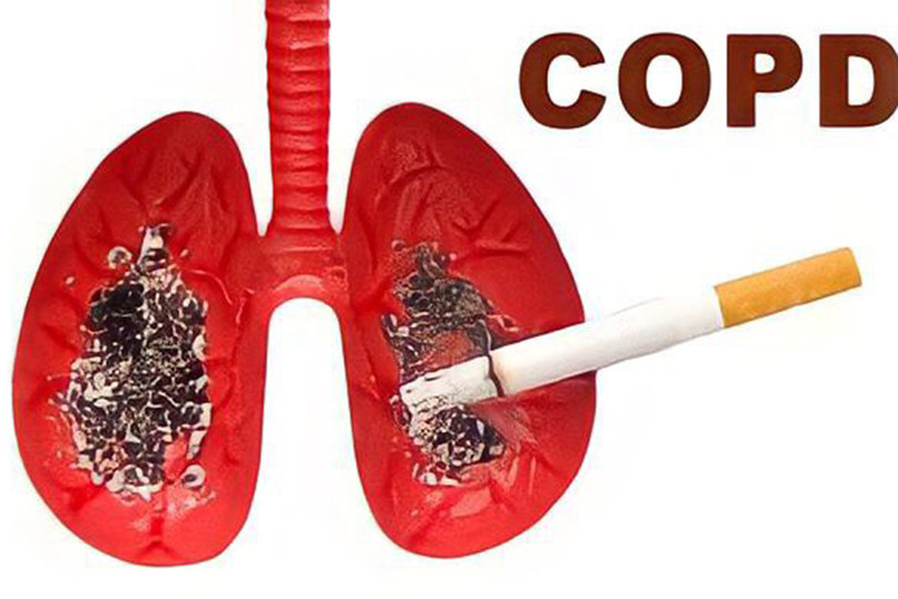 Bỏ thuốc lá tăng hiệu quả điều trị bệnh phổi tắc nghẽn mãn tính