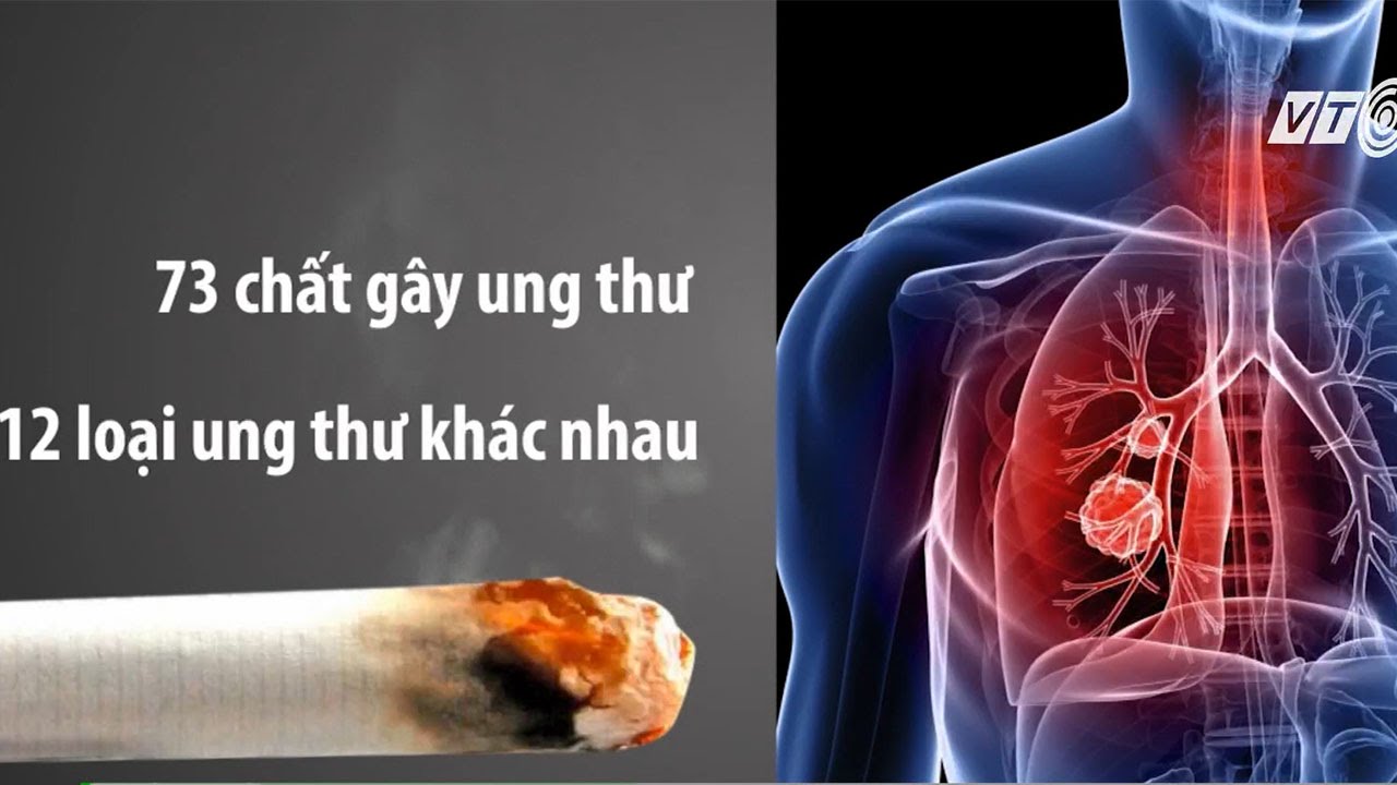   THUỐC LÁ VÀ UNG THƯ