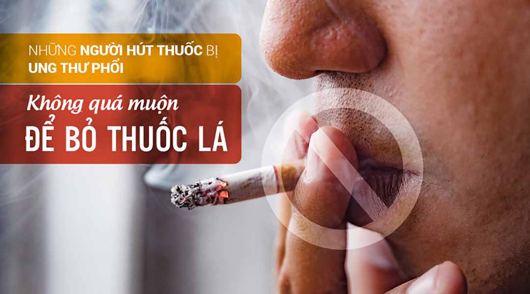   Hút thuốc lá có thể gây ung thư nhiều bộ phận